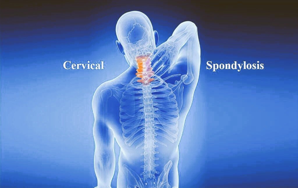cervical